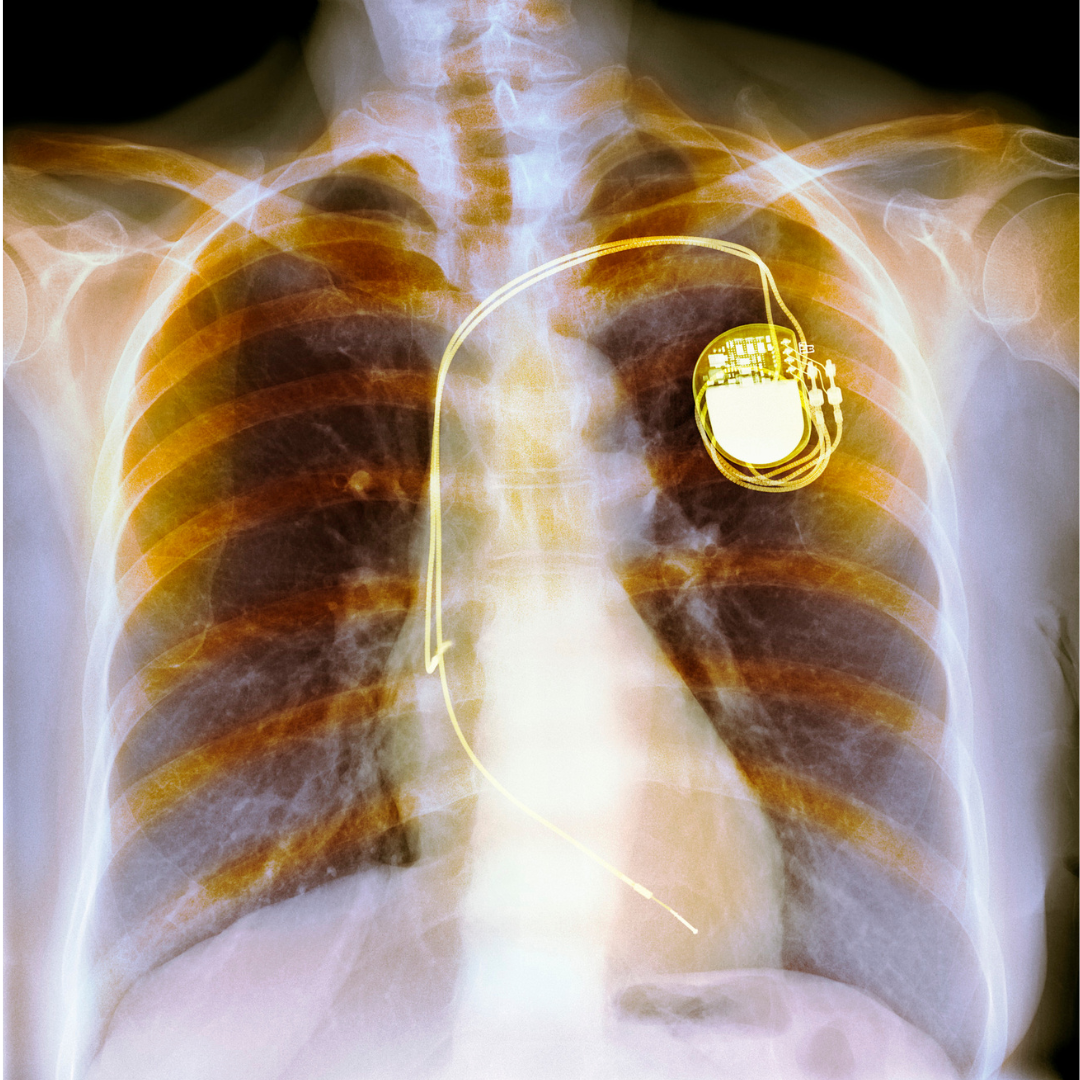 AI-Assisted Medical Imaging